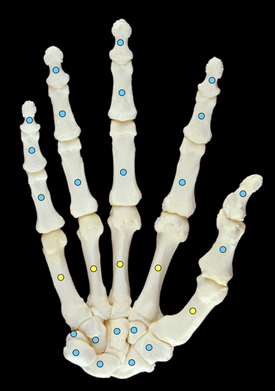 <p>in hand</p>