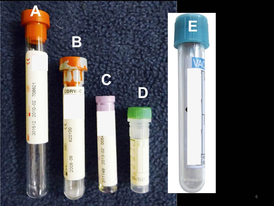 <p><span>Select the description in the right column that matches the letter in the left column (representing the collection tubes below).</span></p>