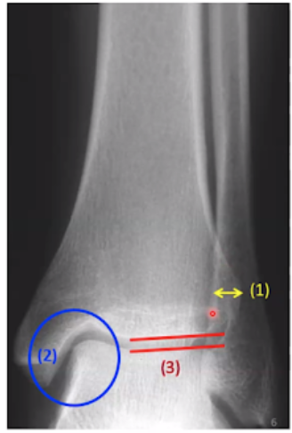 <p>What is shown in this view?</p>