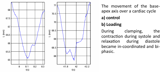 <p>the contraction during systole and relaxation during diastole became in-coordinated and bi-phasic</p>