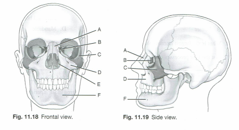 <p>15c. The single facial bone and the one pair of facial bones not visible from the exterior and not demonstraed in Figs 11.18 and 11.19 are the __________ and the ___________ respectively.</p>
