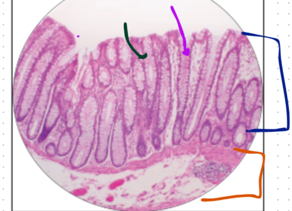 <p>What is this histology slide?</p>