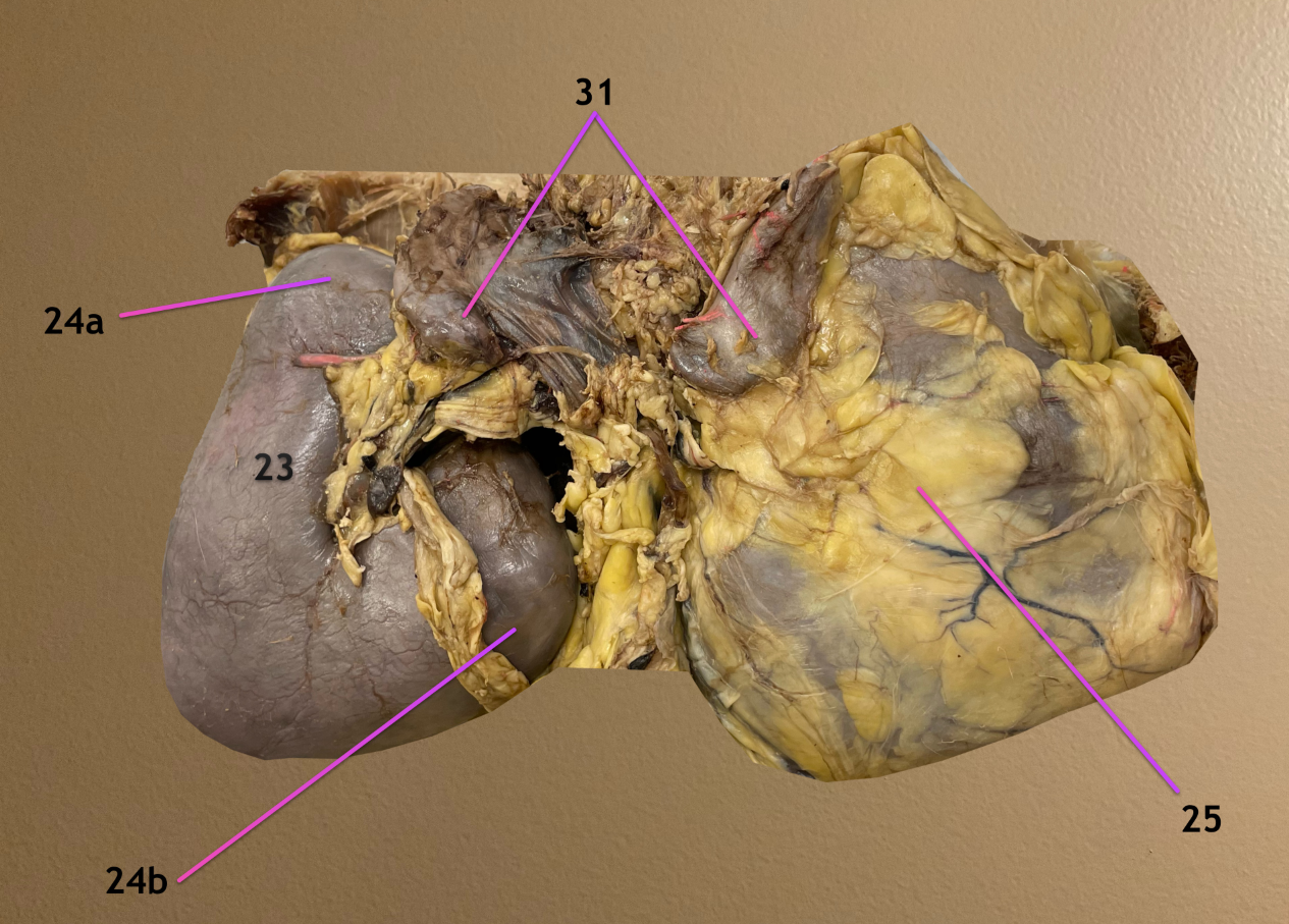 <p>ventral view</p><p>.</p><p>label 23, 24a, 24b, 25, 31</p>