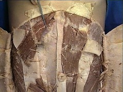 <p>Identify the structure</p>
