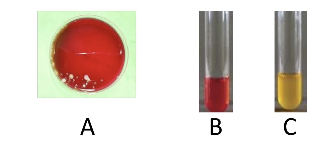 <p>m-Staphylococcus Broth Test/Gram Positive Cocci Experimentation Day # 1</p><p>a) Medium?</p><p>b) Substrate?</p><p>c) Enzyme?</p><p>d) Indicator/Reagent?</p><p>e) End Product?</p>