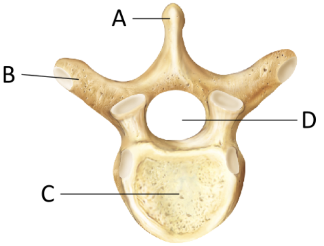 <p>To what region of the vertebral column does this vertebra belong?</p>