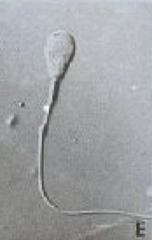 <p>What is this? Normal or abnormal sperm?</p>