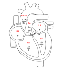 <p>24/10 mmHg</p>