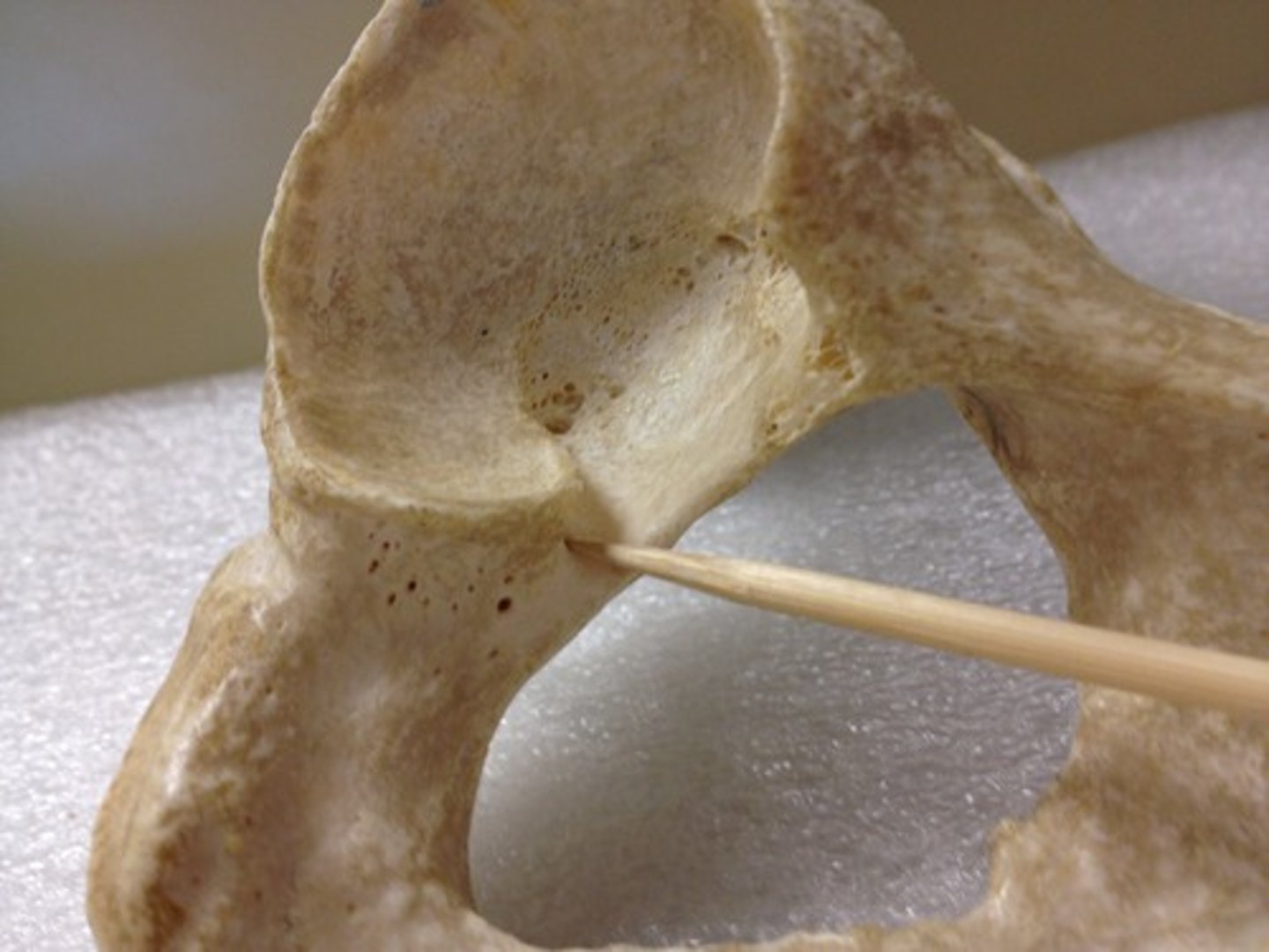 <p>pelvis - lateral</p>