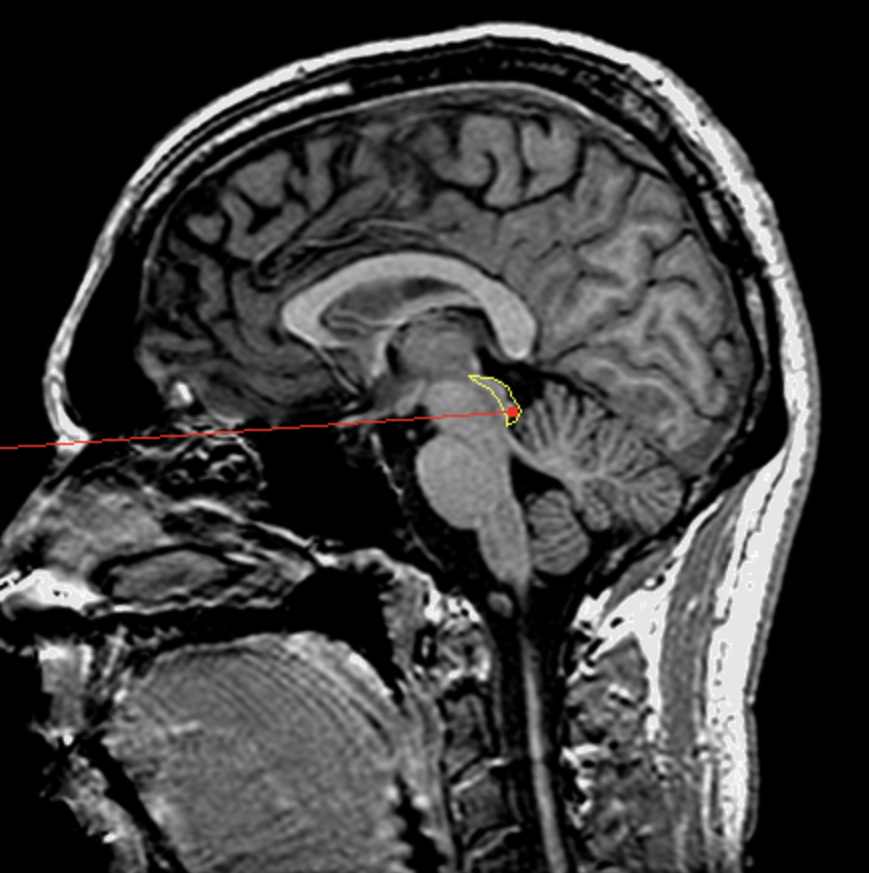 <p>What is the area highlighted called?</p>