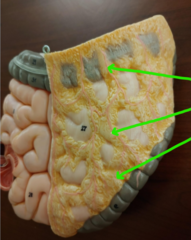 <p>The green arrows are pointing to what structure?</p>