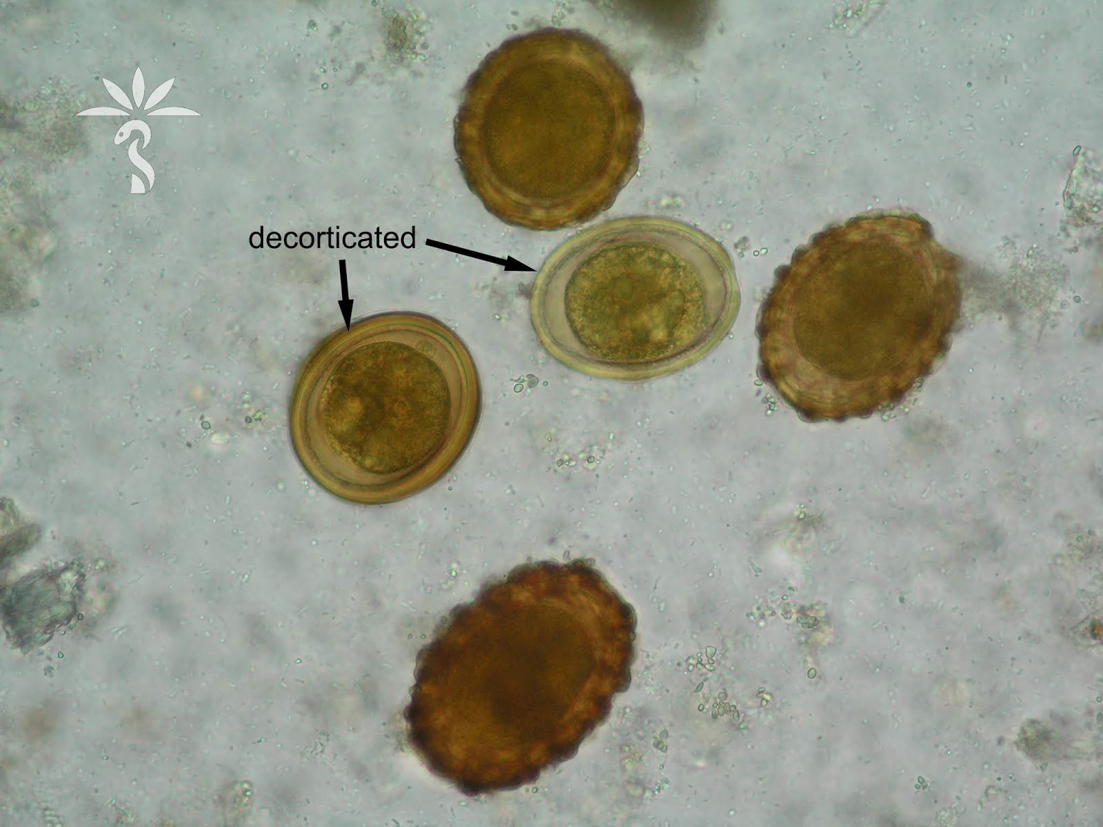 <p>still fertilized egg<br>potentially infective if embryonated</p>