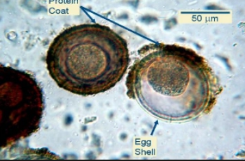 <p>what is it (roundworm)</p>