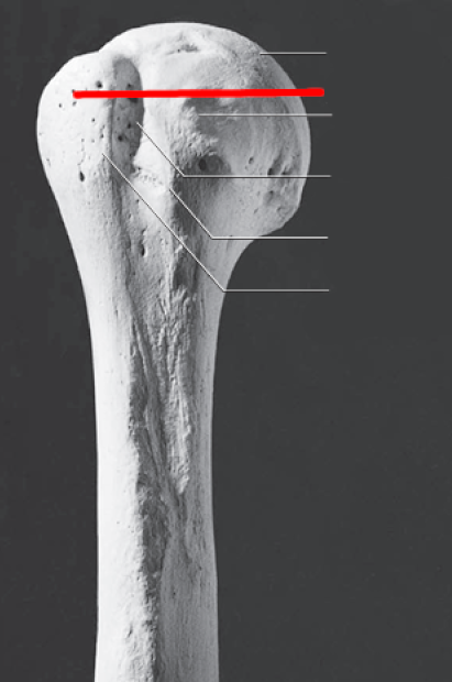 <p>greater tubercle</p>
