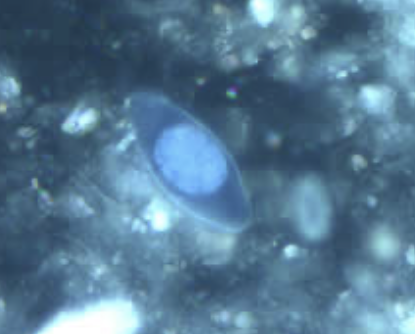 <p>What parasite is this?</p>