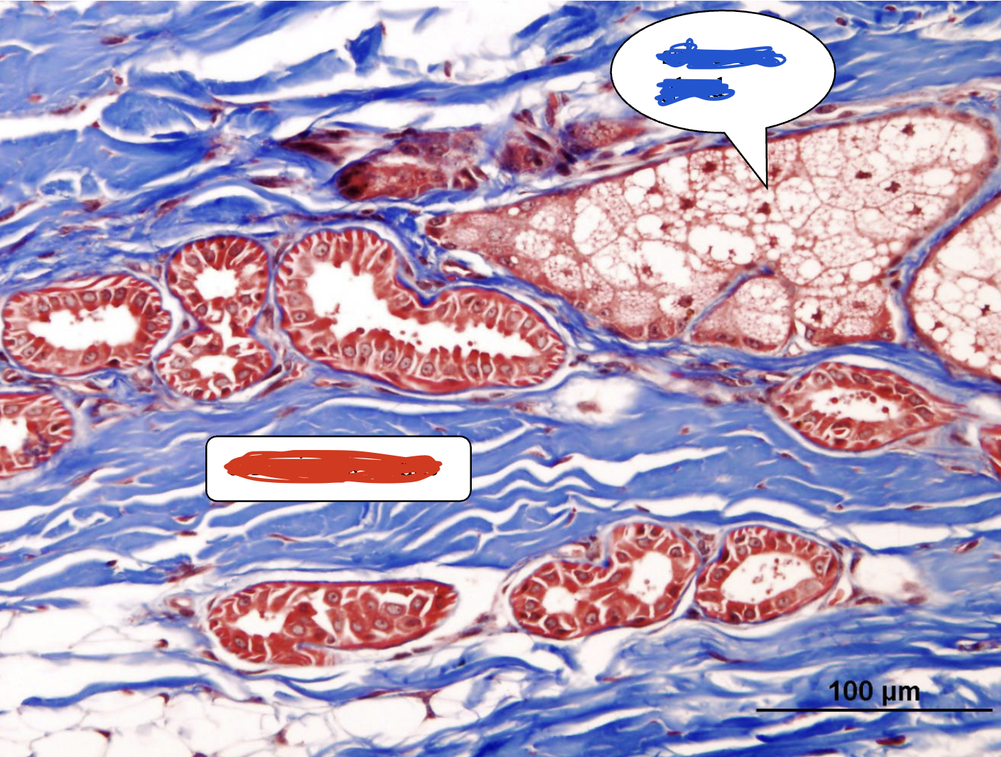 <p>The following is a sample from the ear pinna. What structure is highlighted in blue and what structure is highlighted in red?</p>