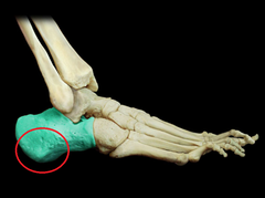 <p>heel of foot</p>