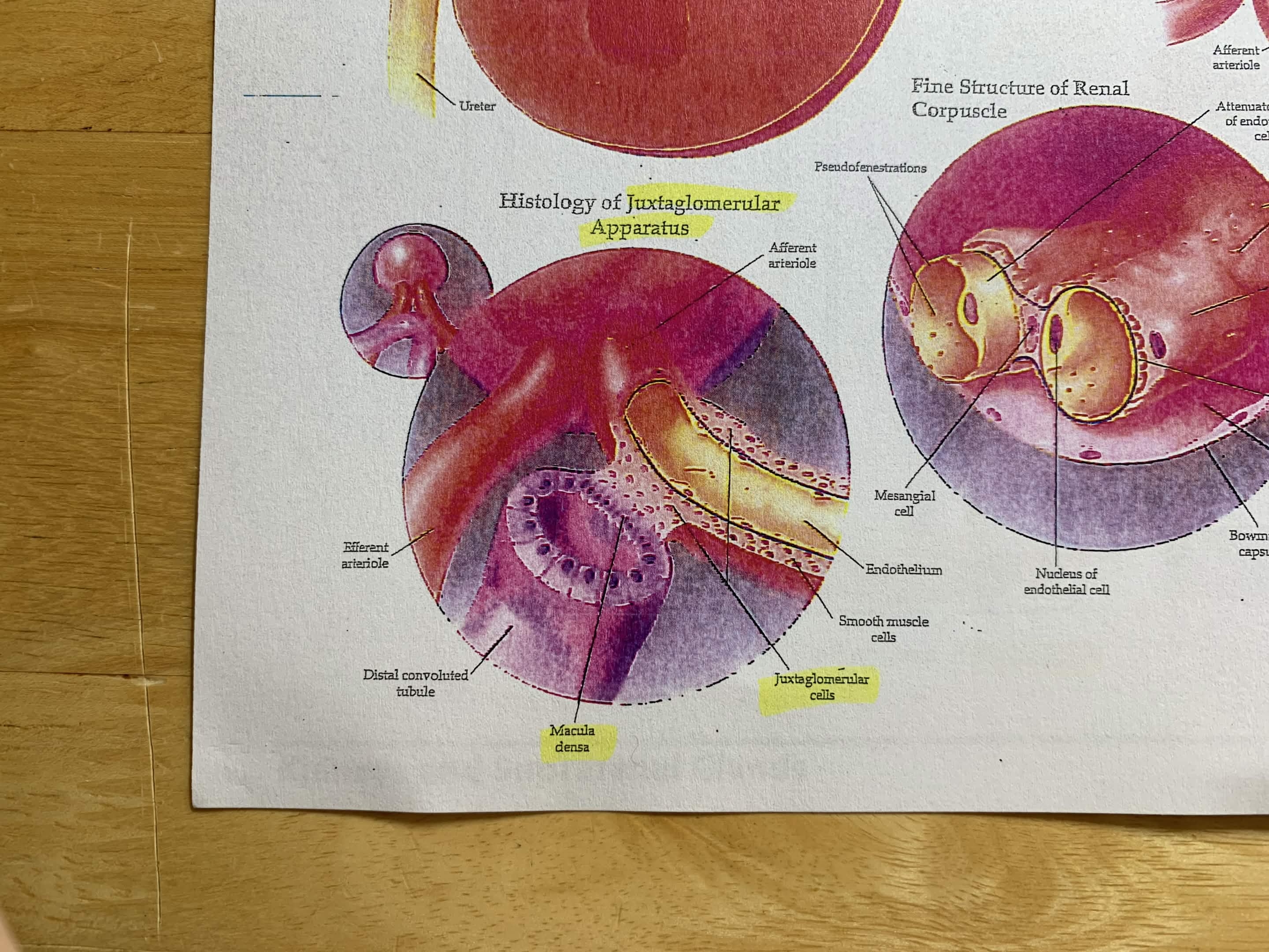 <p>Which part of Distal Convoluted Tubule (DCT):</p><ul><li><p>Between afferent arteriole and distal tubule</p></li><li><p>Made up of macula densa and juxtaglomerular cells</p></li></ul><p></p>