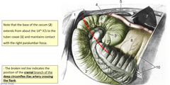 <p>partly in the right paralumbar fossa and partially covered by the ribs</p><p>the ileum enters and the right ventral colon leaves here</p>