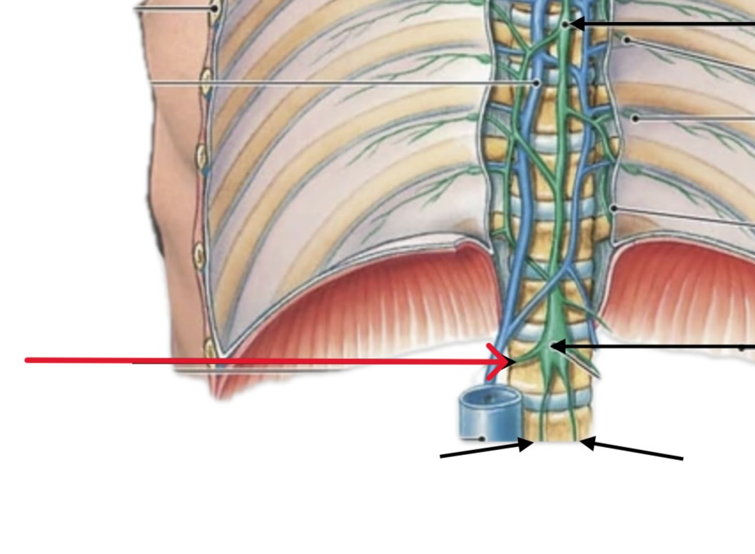 <p>Which lymphatic organ:</p><ul><li><p>The “arms” of cisterna chyli</p></li><li><p>Superior to (R&L) lumbar trunks</p></li></ul><p></p>