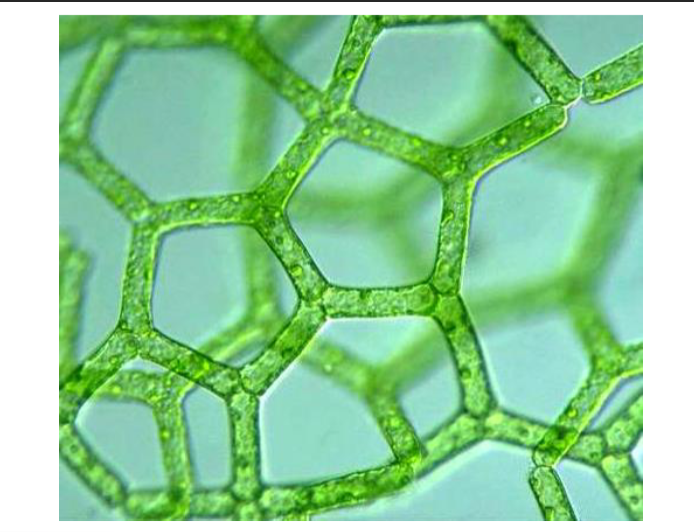<p>archaeplastida, chlorphyta (green algae)</p><p>non motile filament, water net</p>