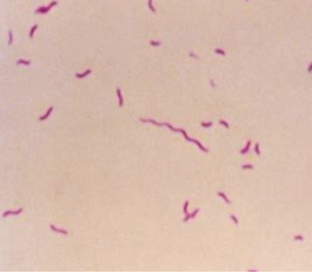 <p>Gram and morphology of this bacteria: pink to red stained bacteria with a rod-shaped morphology but are also curved or spiral</p>