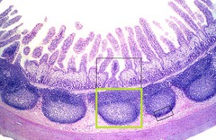 <p>large collections of lymphoid tissue found in the submucosa of the small intestine</p><p>pathogens are transported from gut lumen across mucosa by specialized cells called M cells</p>