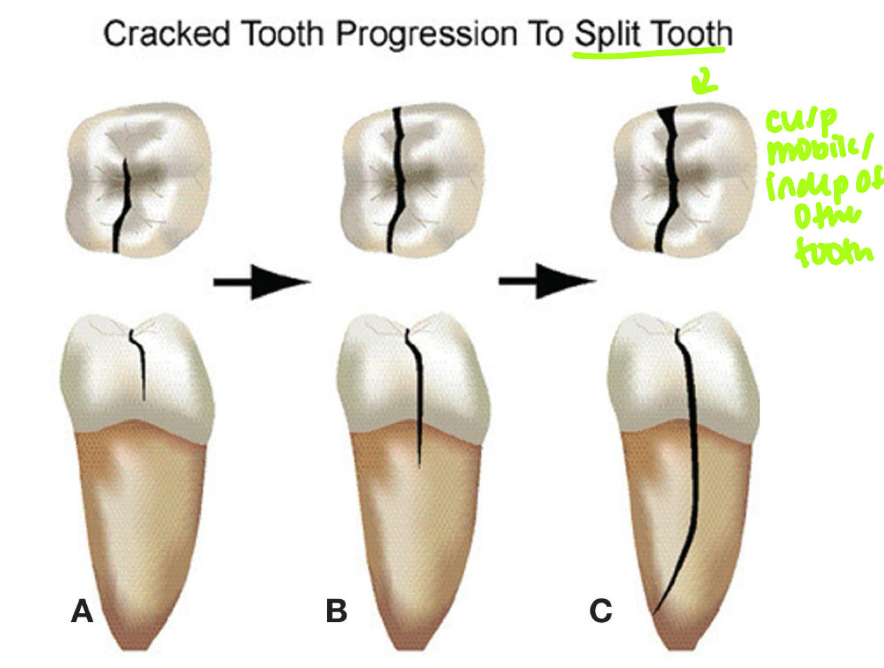 <p>Not typically (due to M-D direction)</p>