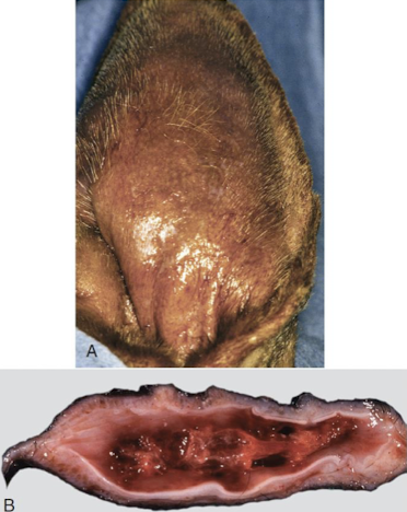 <ul><li><p>Caused by ear discomfort leading to head shaking</p></li><li><p>Head shaking creates shearing forces on blood vessels</p></li><li><p>Can fracture auricular cartilage</p></li><li><p>Hemorrhage collects:</p><ul><li><p>Intraparachondrially</p></li><li><p>Subparachondrially</p></li></ul></li><li><p>Common in:</p><ul><li><p>Pigs</p></li><li><p>Dogs</p></li><li><p>Cats</p></li></ul></li><li><p>If untreated:</p><ul><li><p>Heals by fibrosis</p></li><li><p>Causes a malformed auricle</p></li></ul></li></ul><p></p>