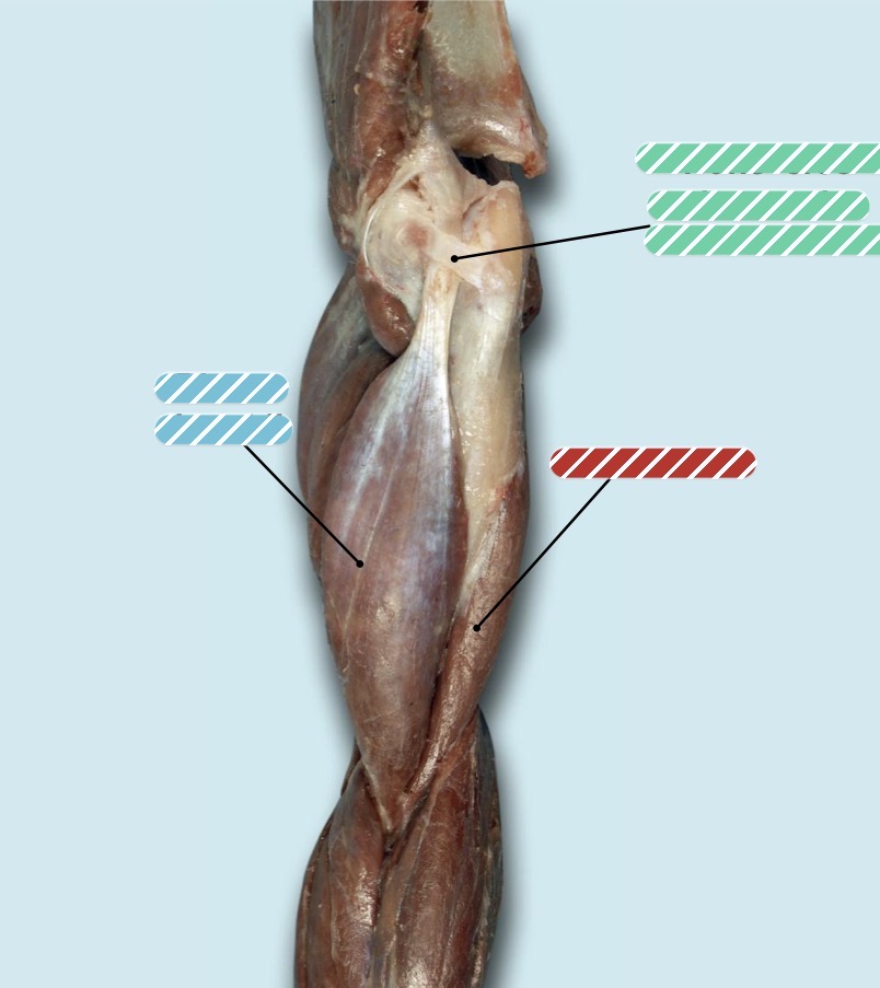 <p>Identify the muscle in blue</p>
