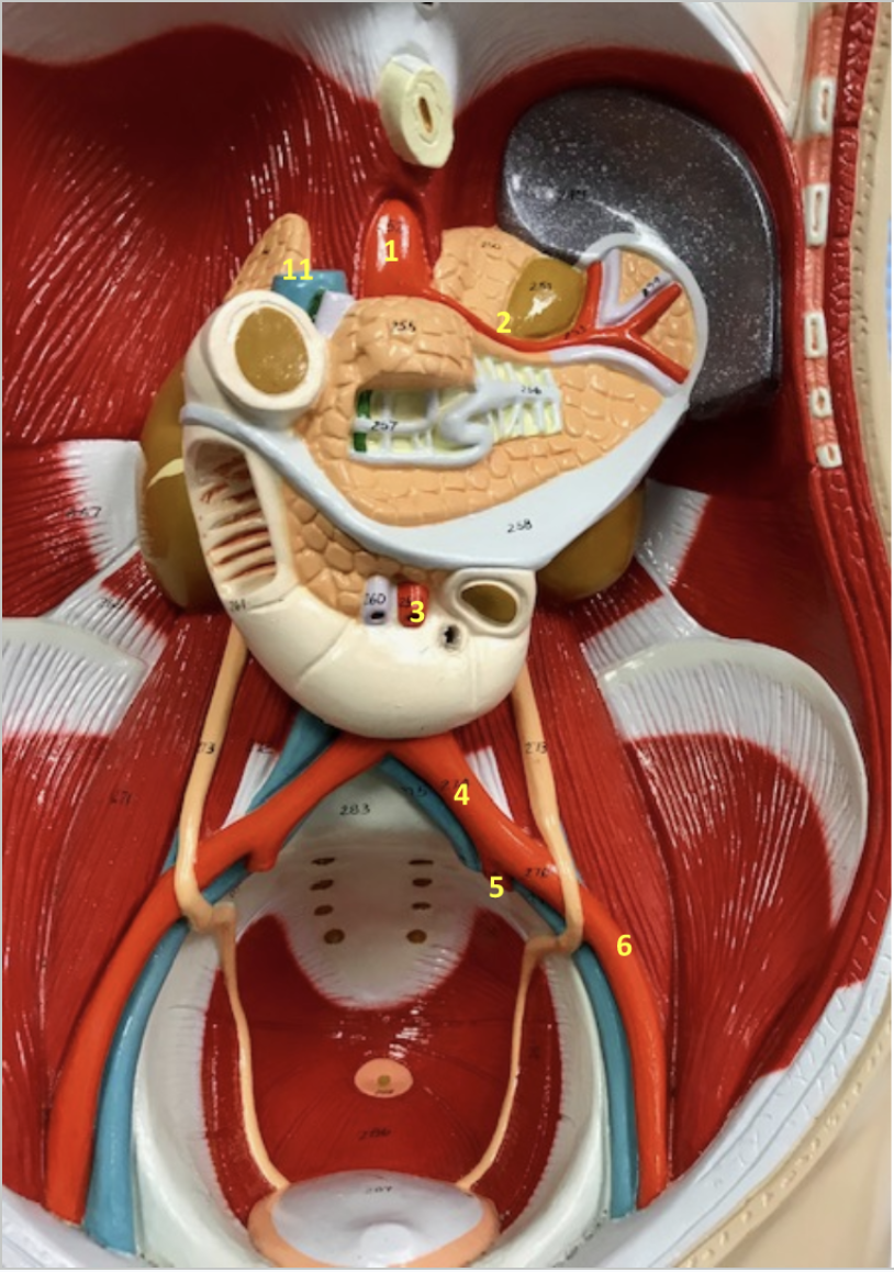 <p>Abdomen/Pelvis</p><p>1. Abdominal aorta</p><p>2. Splenic artery</p><p>3. Superior mesenteric artery</p><p>4. Left common iliac artery</p><p>5. Left internal iliac artery</p><p>6. Left external iliac artery</p>