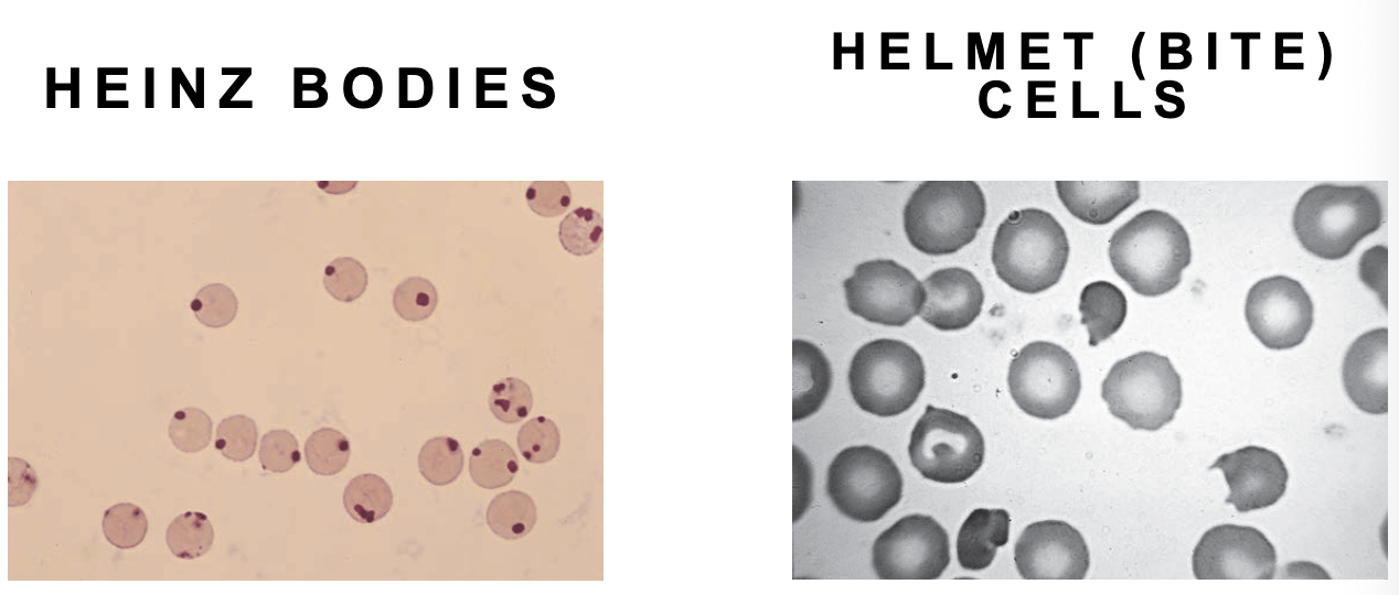 <ul><li><p><strong>normocytic / normochromic anemia</strong></p></li><li><p>reticulocytosis</p></li><li><p>anisocytosis</p></li><li><p>poikilocytosis</p></li><li><p>spherocytosis</p></li><li><p><strong>Helmet Cells</strong></p></li><li><p><strong>Heinz Bodies </strong></p></li></ul><p></p>
