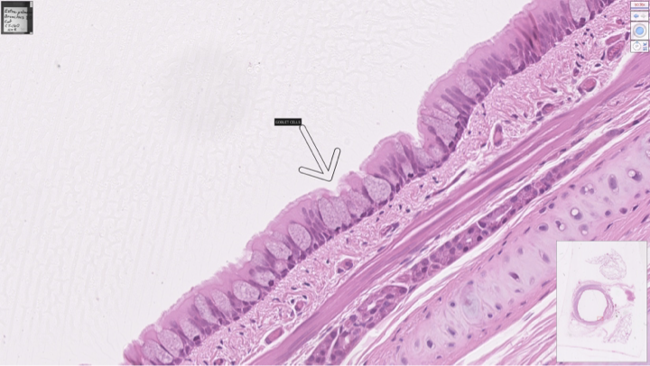 <p>pseudostratified columnar (ciliated)</p>