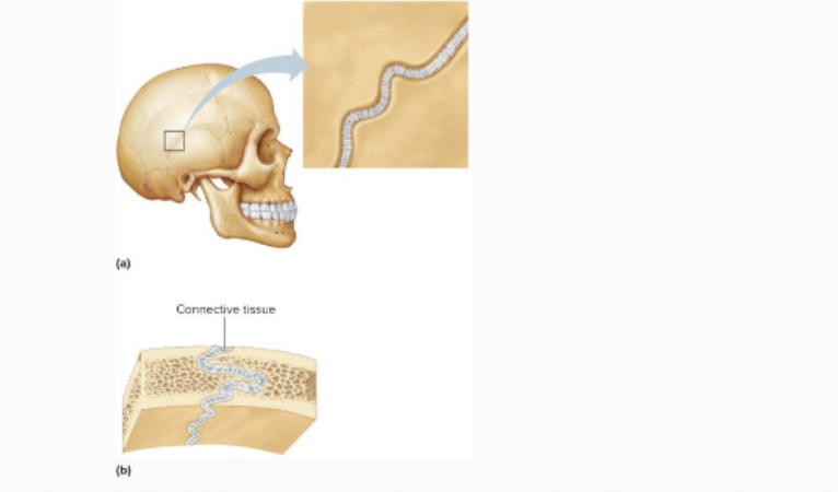 <ul><li><p>only between flat bones of skull </p></li><li><p>thin layer of dense CT (sutural ligament) connects bones </p></li><li><p>synnarthrotic- immovable after development, ampiarthrotic in developing skill </p></li></ul><p></p>