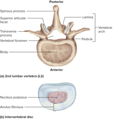 <p>General Structure of a Vertebra</p>