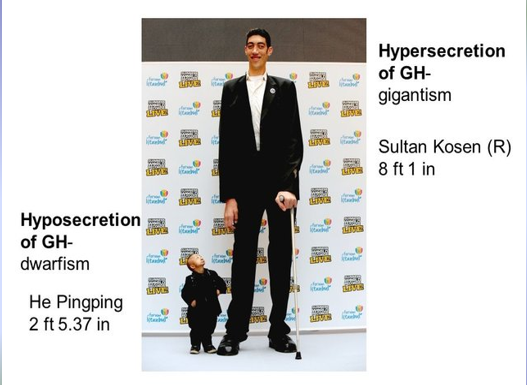 <p>Growth Hormone Dysfunction Affects Height</p>