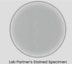<p>Troubleshoot the following:</p><p>Your lab partner is preparing a smear for simple staining from a solid culture. Oddly, the stained slide doesn't appear to have any cells on it. What went wrong?</p><p> </p><p>too much stain was applied to the specimen</p><p> </p><p>the sample was heat-fixed for too long</p><p> </p><p>the cells were rinsed with deionized water for too long</p><p> </p><p>the cells were inadequately heat-fixed</p>