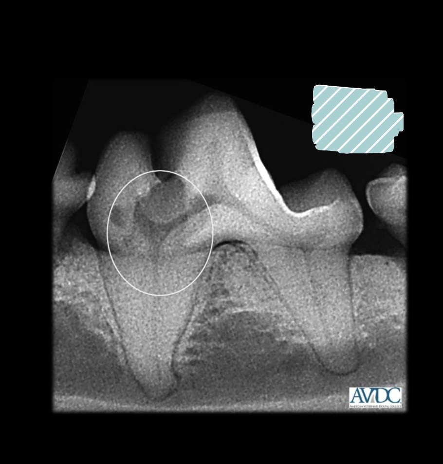 <p>what stage of tooth resorption is this?</p>