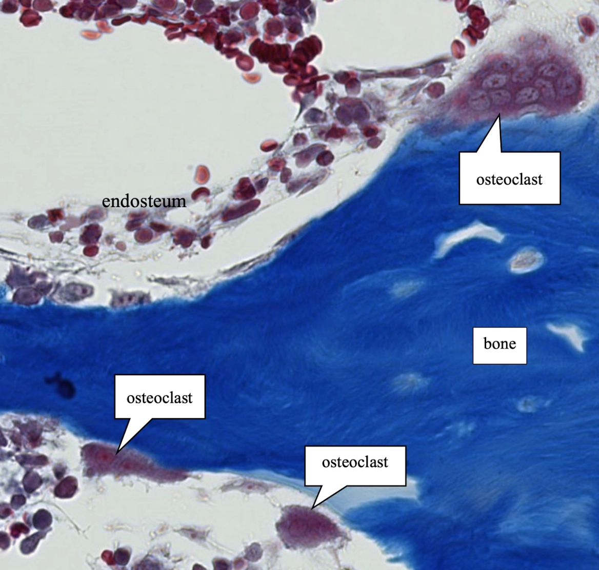 <p>Look for a large multinucleated giant cell associated with an erosion lacuna, a space created where the cell is actively resorbing bone.</p>