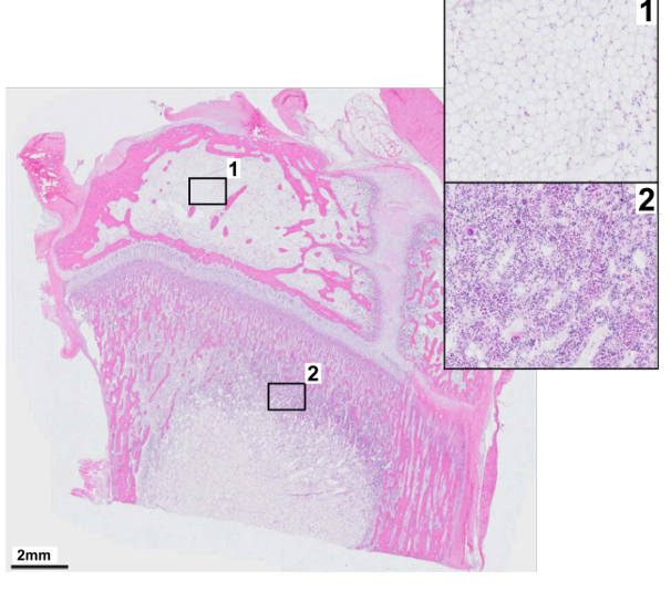 <p><strong>A21) Specify the colors of tissue type 1 and tissue type 2 in a fresh unfixed preparation (in vivo).</strong></p>