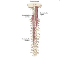 <p>Semispinalis Capitis</p><p>Attachment</p>