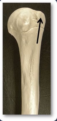 <p>small, rounded projection </p>