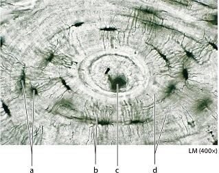 <p>Identify the structure labeled “d".”</p><p>a. central canal</p><p>b. lacuna</p><p>c. canaliculi</p><p>d. lamella</p>
