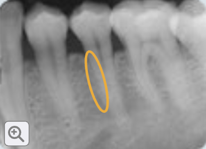 <p>cementum</p>