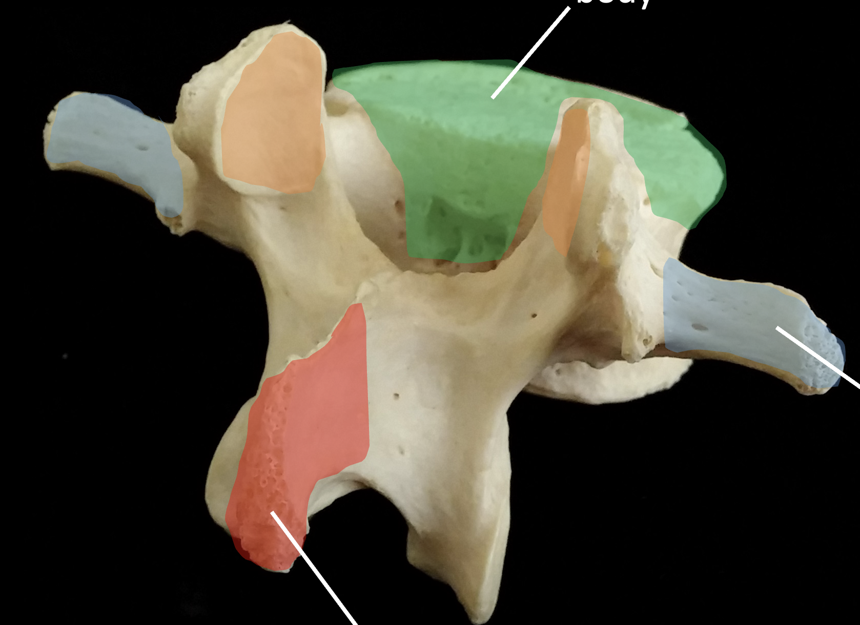 <p>What is the orange region highlighted on the lumbar vertebrae?</p>
