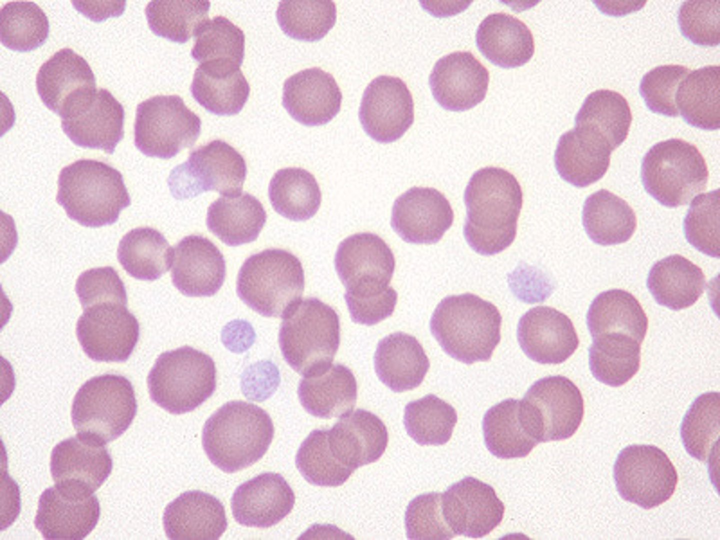 <p>type of connective tissue?</p>