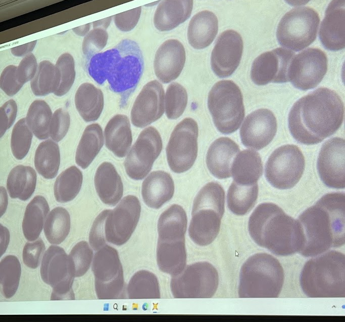 <p>The slide depicts which type of leukocytes</p>
