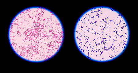 gram negative