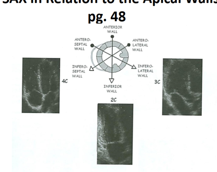 <p>The order to Visualize all walls in the Apical Window </p>