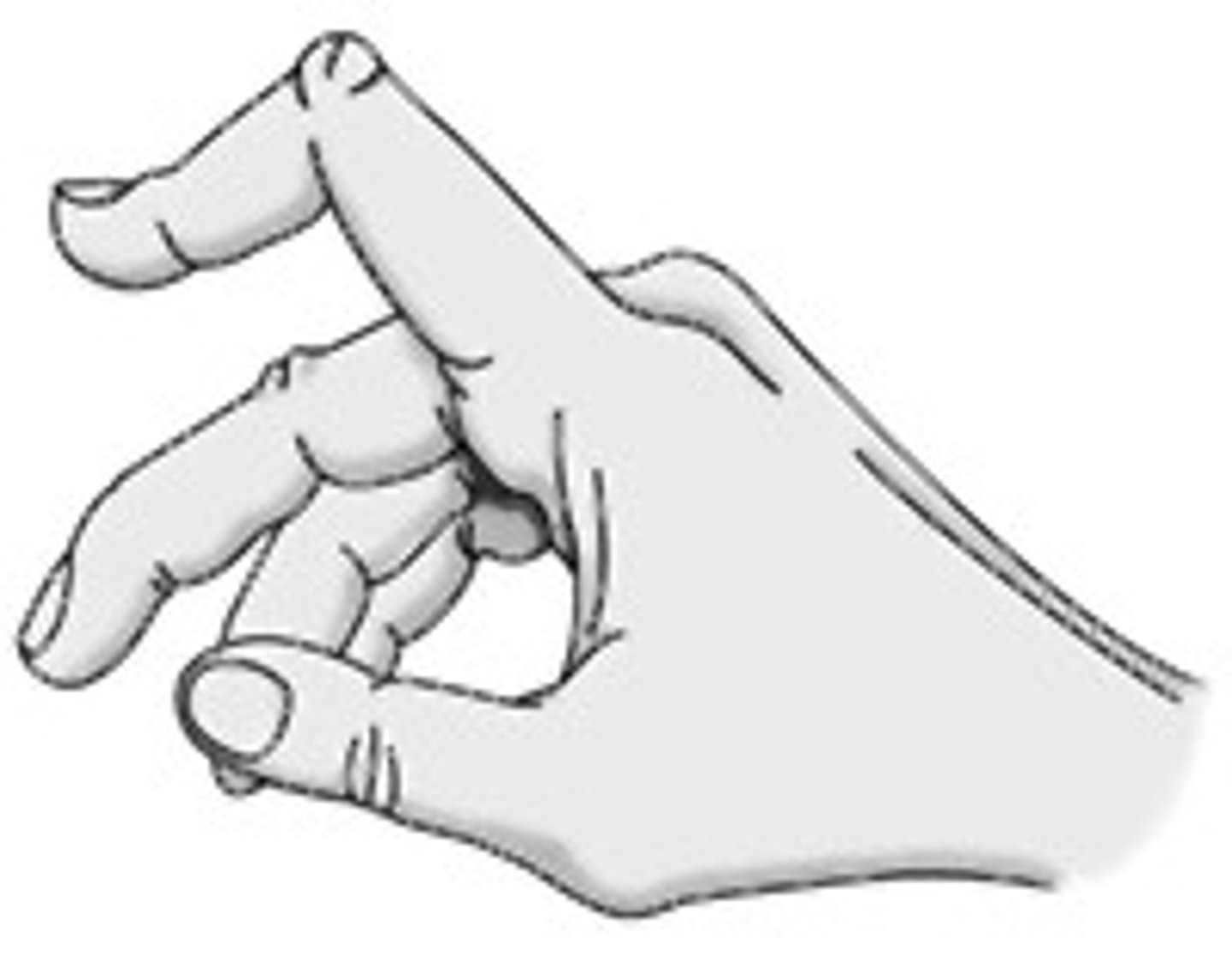 <p>PIP flexed &amp; DIP extended</p><p>-lateral bands get too short/tight &amp; slide ANTERIOR</p>